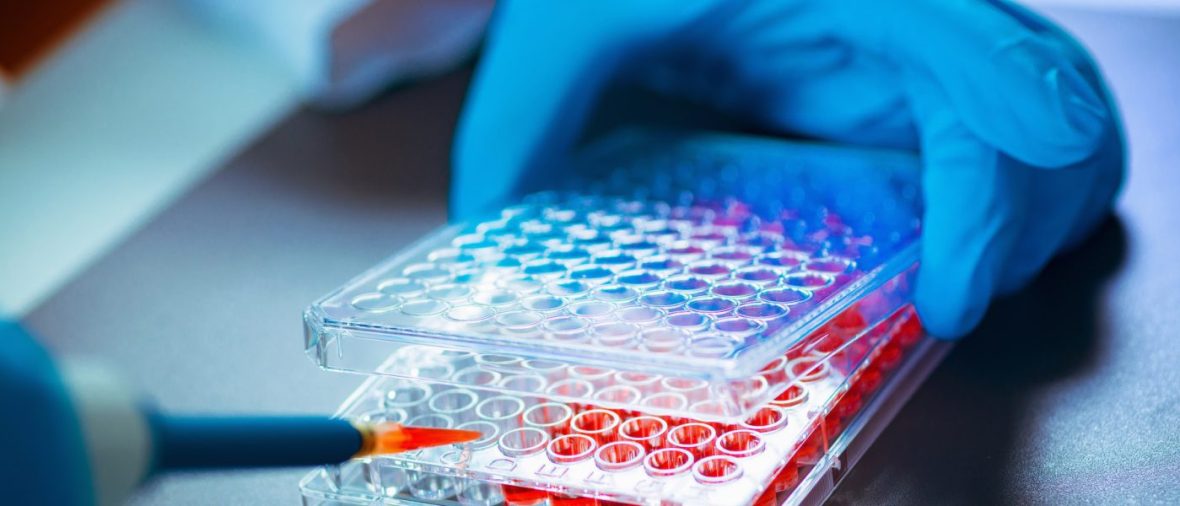 Lab assistant working with Vile Samples